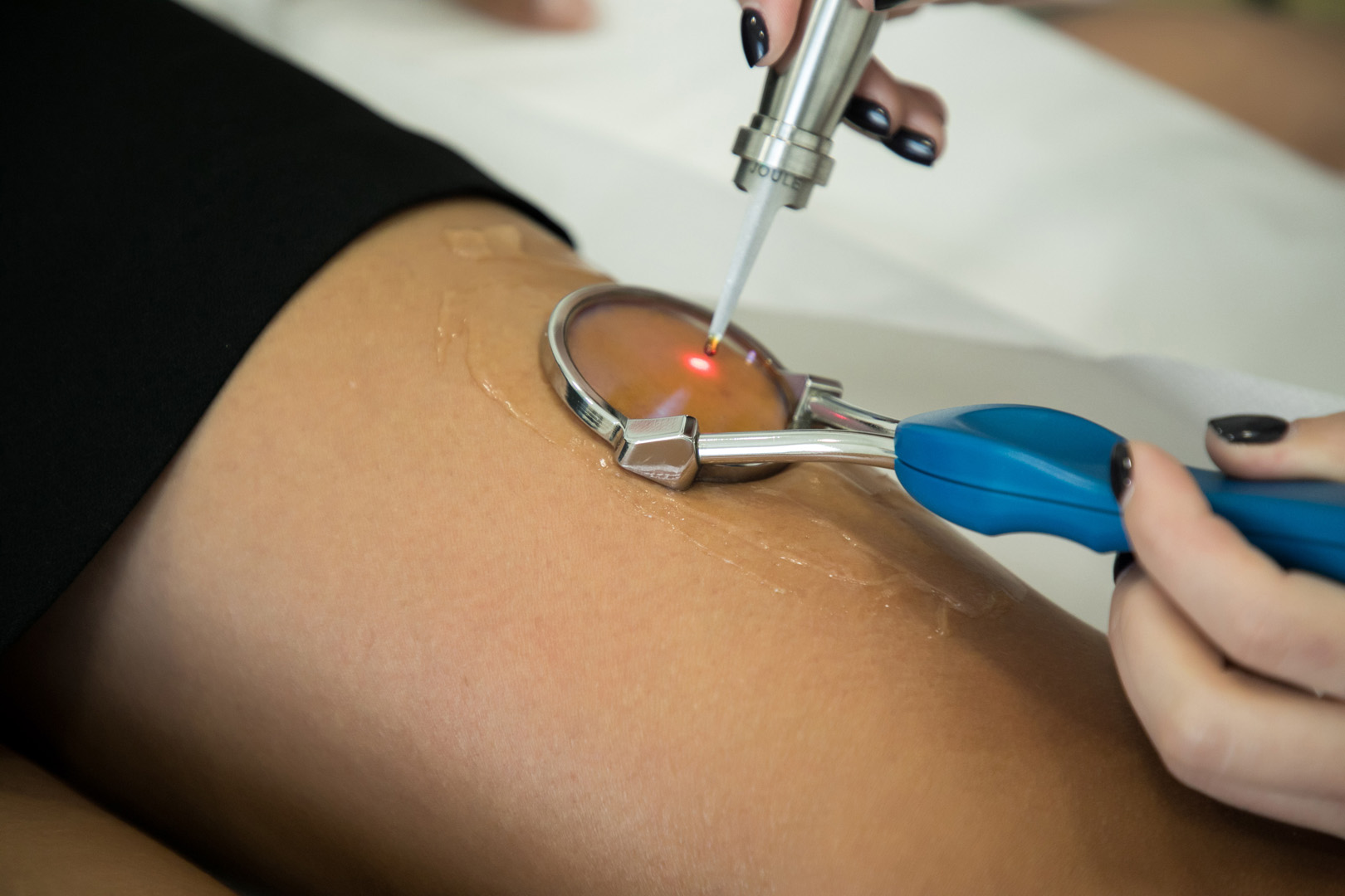 Clinica Alderma_394